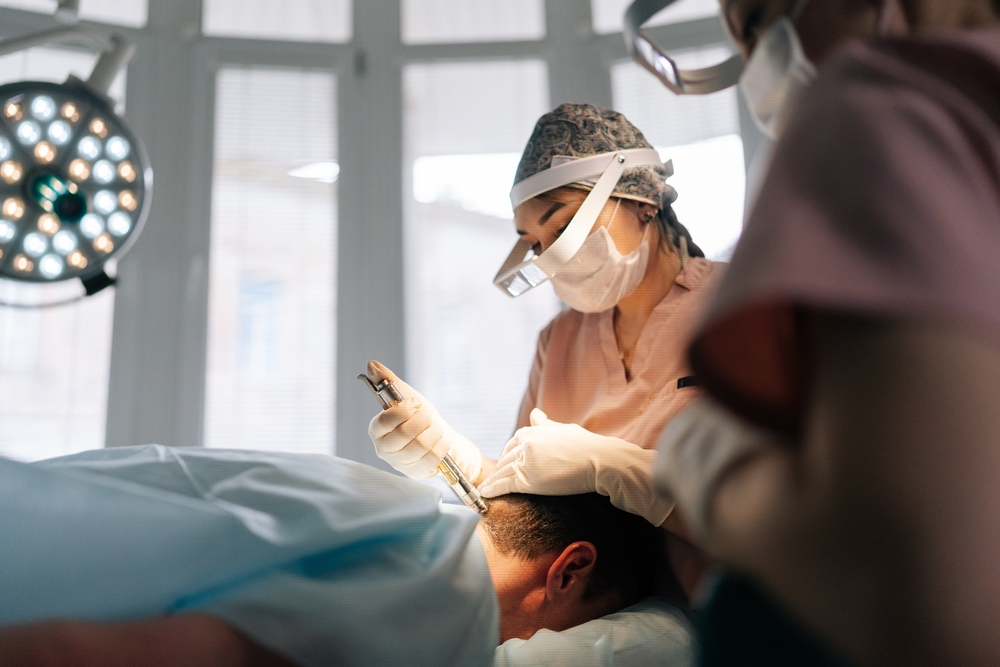 Megasesiones de Implante Capilar: ¿Cómo recuperar la densidad en 1 día?